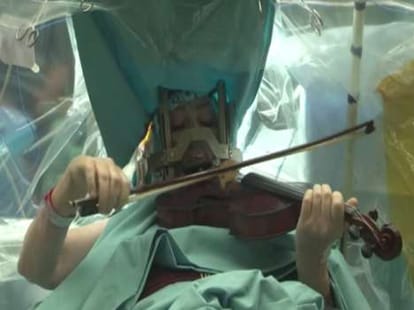 woman undergoes brain surgery while playing violin