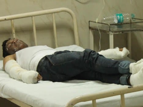 11 Charred after cylinder explosion in mendhar