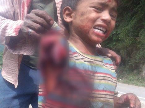 child hand cut in trolly