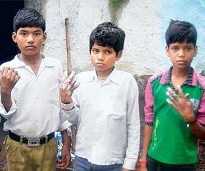 Trial fire Theft accused boys MP forced dip hands BOILING OIL prove innocence