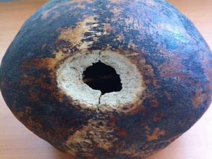 brain surgery 2300 years ago baffles scientists 