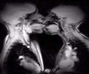 mri scanning of couple during sex filmed