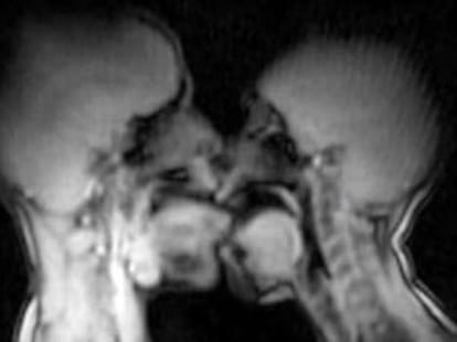 mri scanning of couple during sex filmed