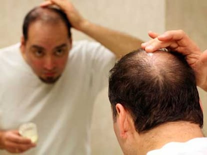 baldness cure key element is discovered