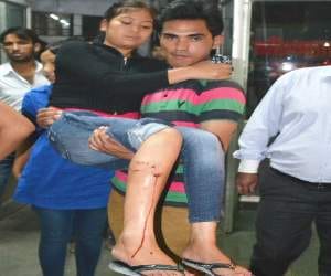 30 people bitten by rabid dogs