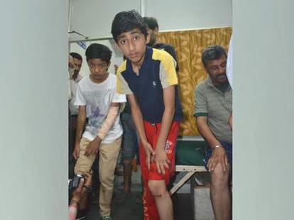 30 people bitten by rabid dogs