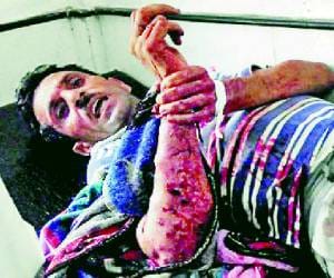 four injured in land dispute