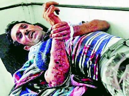 four injured in land dispute