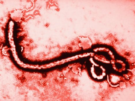 elart from ebola in uttarakhand