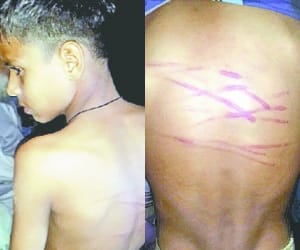 teacher badely beat student with iron wire