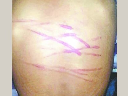teacher badely beat student with iron wire