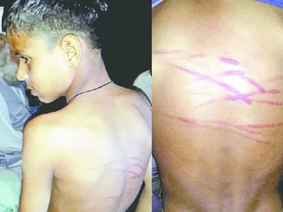 teacher badely beat student with iron wire