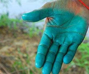 why do farmers spray disinfectant in crops?