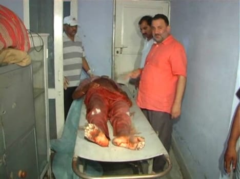 GMC was filled with firing injured