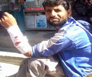 bear attack on man at rampur. 