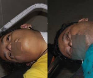 After autopsy the bodies handed over