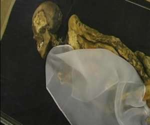 cannabis used to treat extreme physical pains
