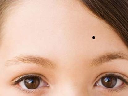 Having A Mole On These Parts Of The Body Is Really Lucky - Amar Ujala