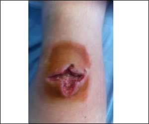 man sues hospital for not detecting teeth in his knee