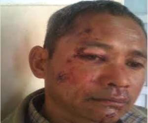 leapord attack at bhatakuffar shimla.