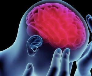 brain stroke treatment in lucknow
