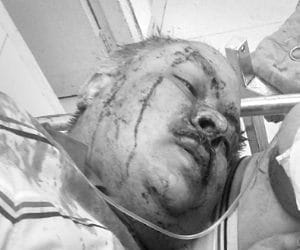 One Crore Robbery in Chandigarh, Businessman Injured