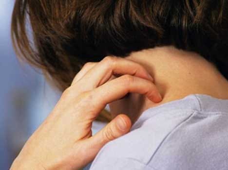 facts about itching