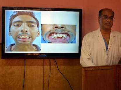first success implant jaw in the country.