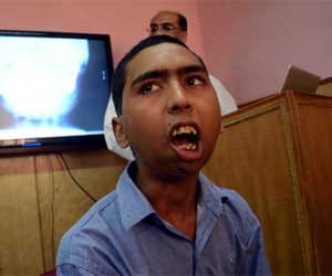 first success implant jaw in the country.