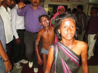 15 people injured in a ballone blast.