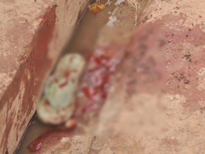 hyena killed a five year old girl.