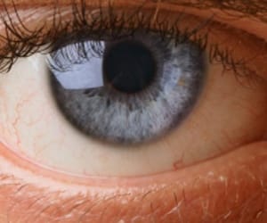 eye donation after death.