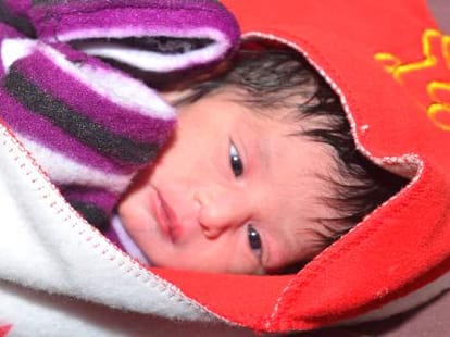 Premature child become blind from a disease.