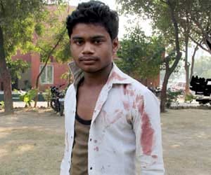 teachers knockout student in greater noida school, head abscess