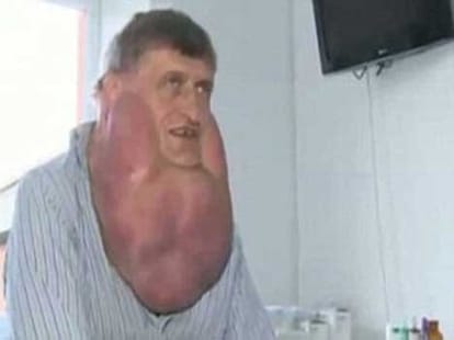 worst tumour cases of 2014