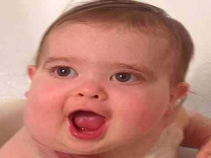 tumour that sprouted from blood vessel in neck