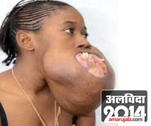 worst tumour cases of 2014
