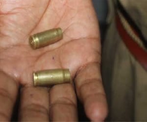 The bullet is stuck in textile businessman shot.