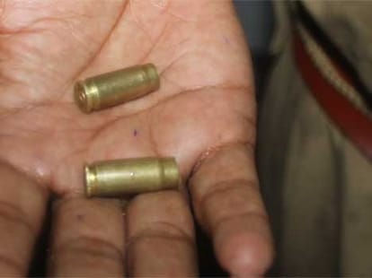 The woman's head touches the bullet