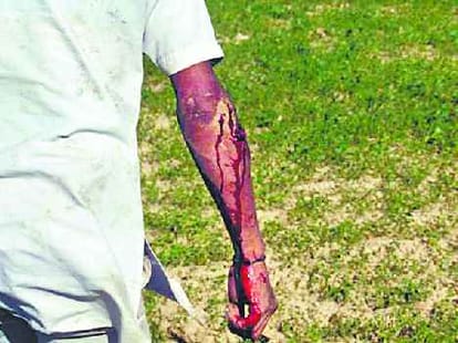 leopard attacks four people in barabanki.