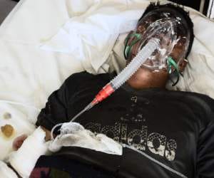 acid attack after molestation in mandi.