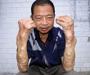 people suffering from unusual swellings