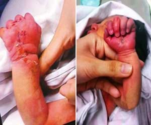 cannabil mom eats her newborn 