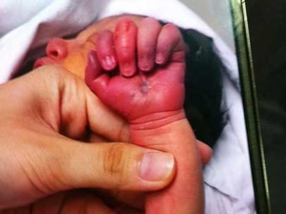 cannabil mom eats her newborn 