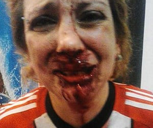 lady beaten badly for supporting her favorite team