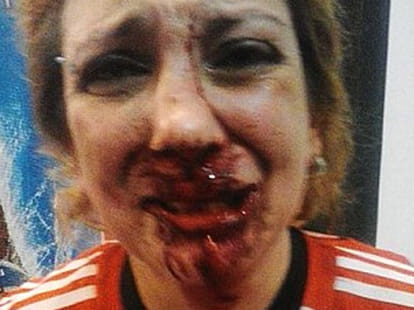 lady beaten badly for supporting her favorite team
