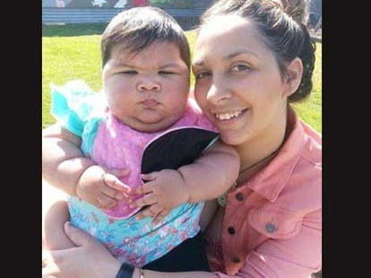 10 month girl who already weighs 25 kilos!