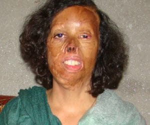 Dabwali Fire Accident, Victims Emotional Story, Must Read