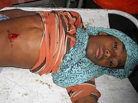 Young man shot fired , serious