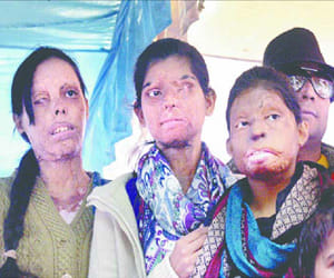 acid attack victims fashion show in ludhiana